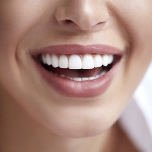 Close-up of beautiful smile with porcelain veneers in Northborough