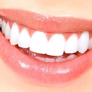 Close-up of beautiful white teeth after professional treatment